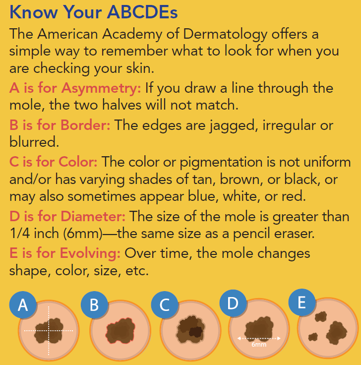 Skin Cancer Diagram