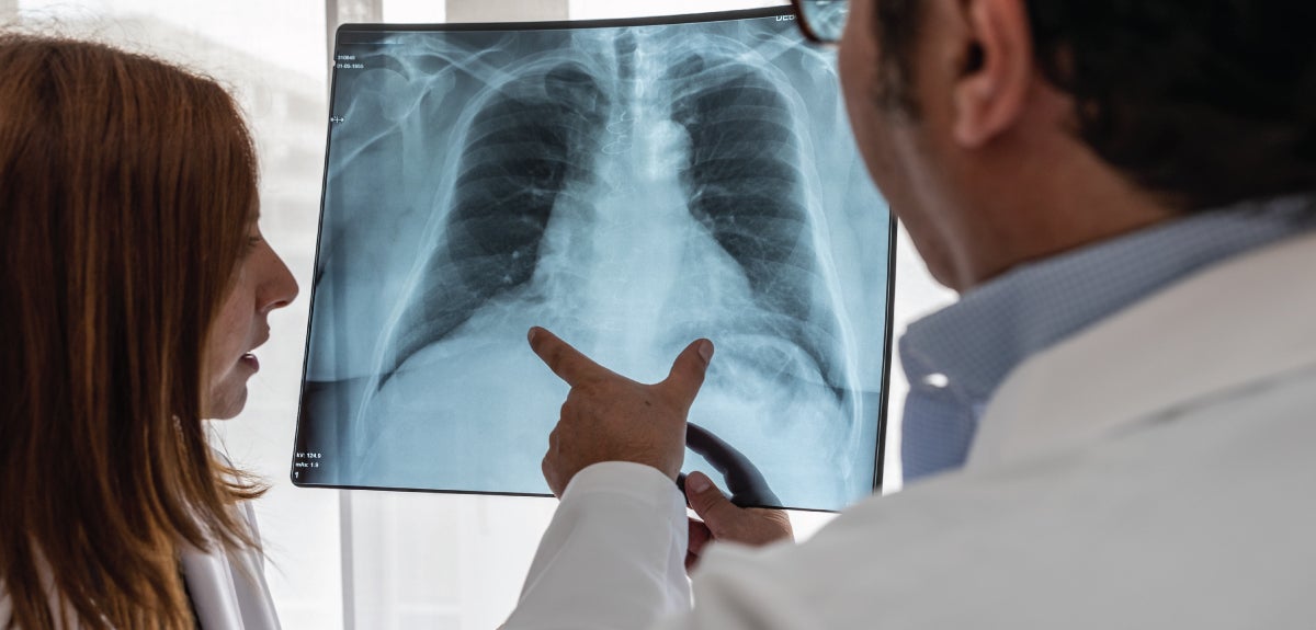 Lung screening program