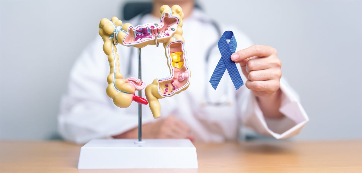 Colon cancer awareness