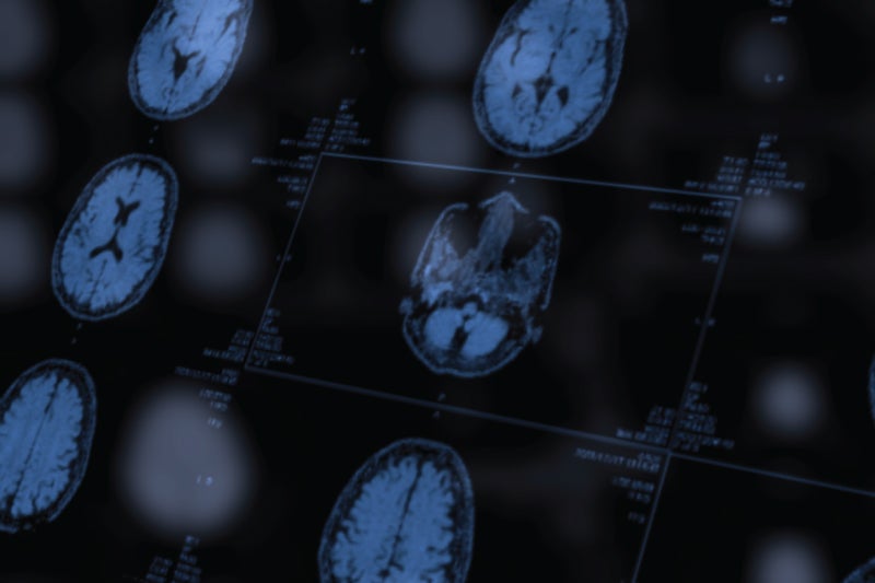 Stroke care
