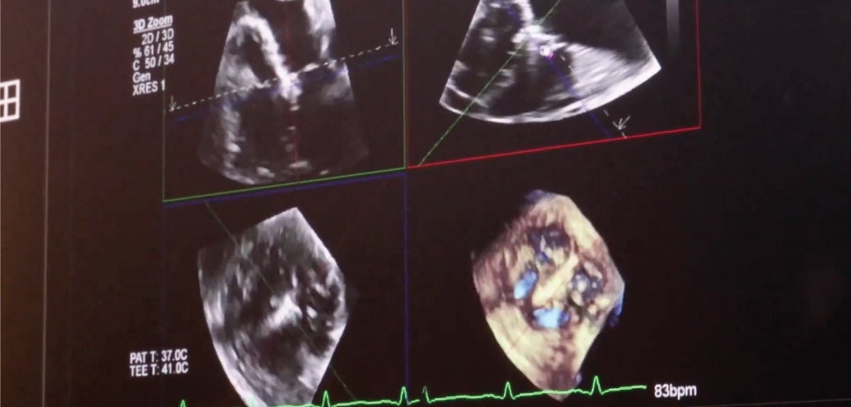 Cardiac imaging screen