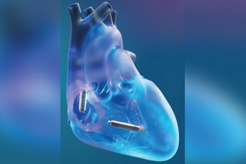 Dual chamber pacemaker