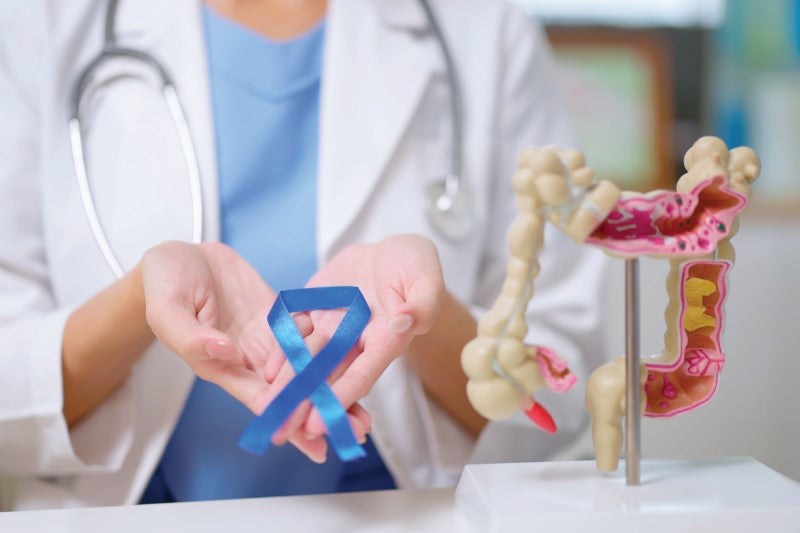 Colon cancer screening