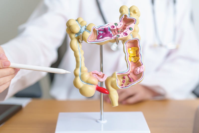 Colon and rectal care