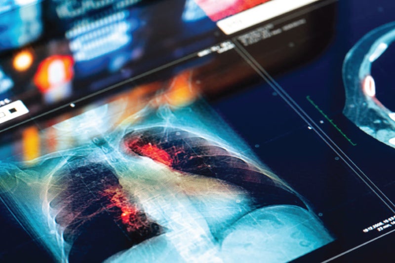 Ion endoluminal scan