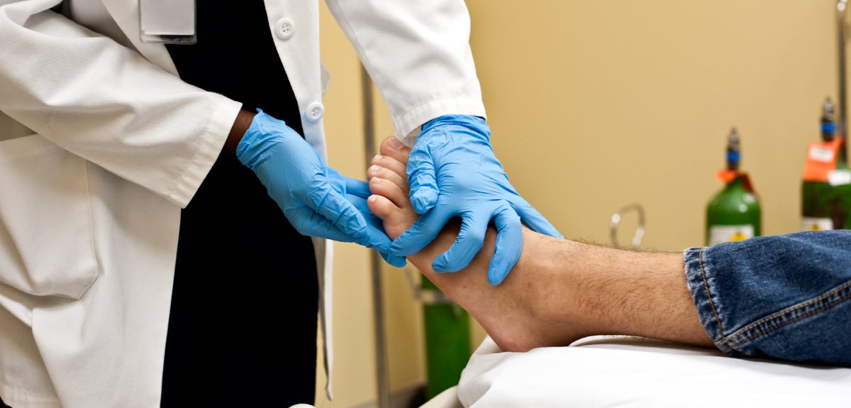 Amputation prevention