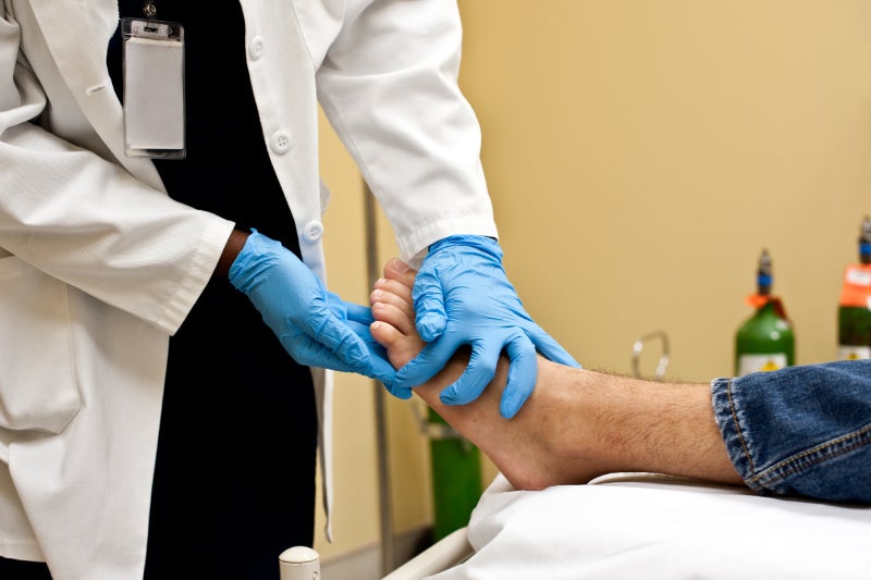 Amputation prevention